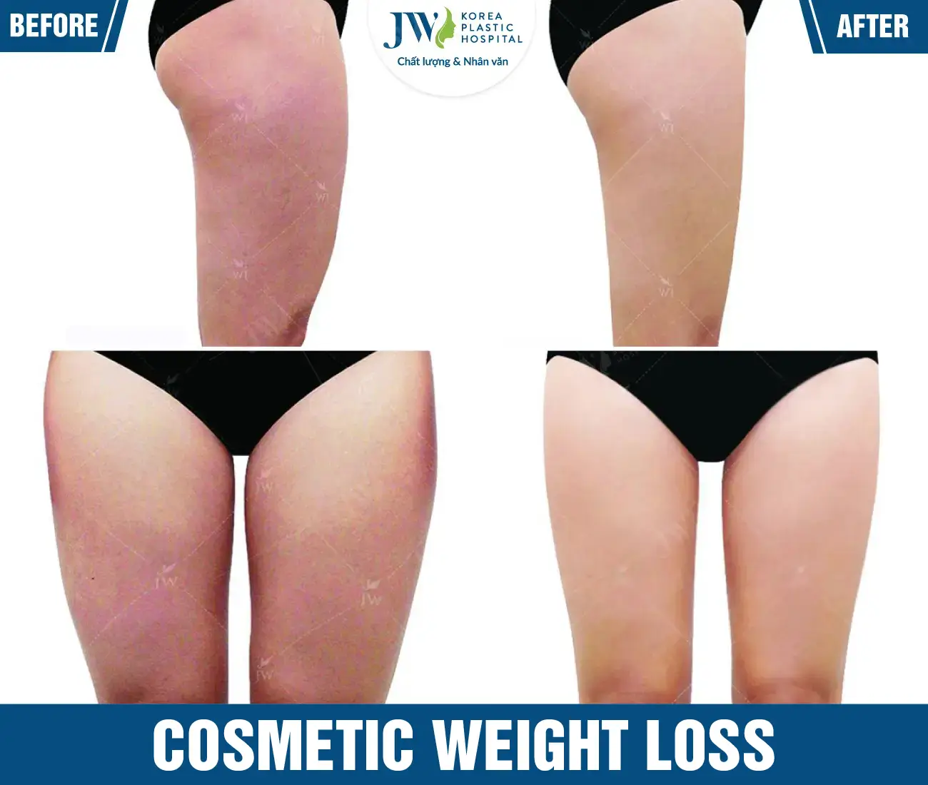 Cosmetic weight loss